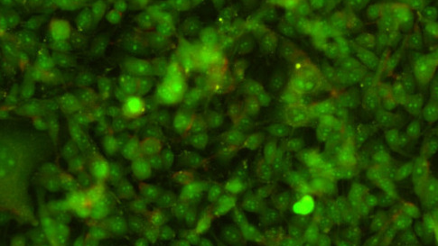 Gold-coated drug nanocapsules show promise for targeted cancer therapy