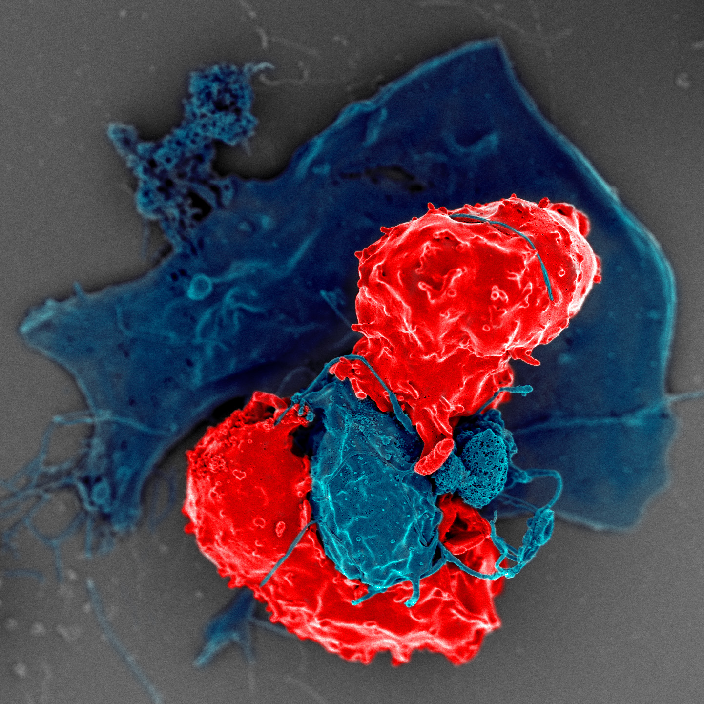 Scanning electron microscope image of a regulatory T cell (red) interacting with another immune cell (blue), helping it verify the presence of pathogens and cancer cells. Image: NIAID, Wikimedia Commons (CC BY 2.0)