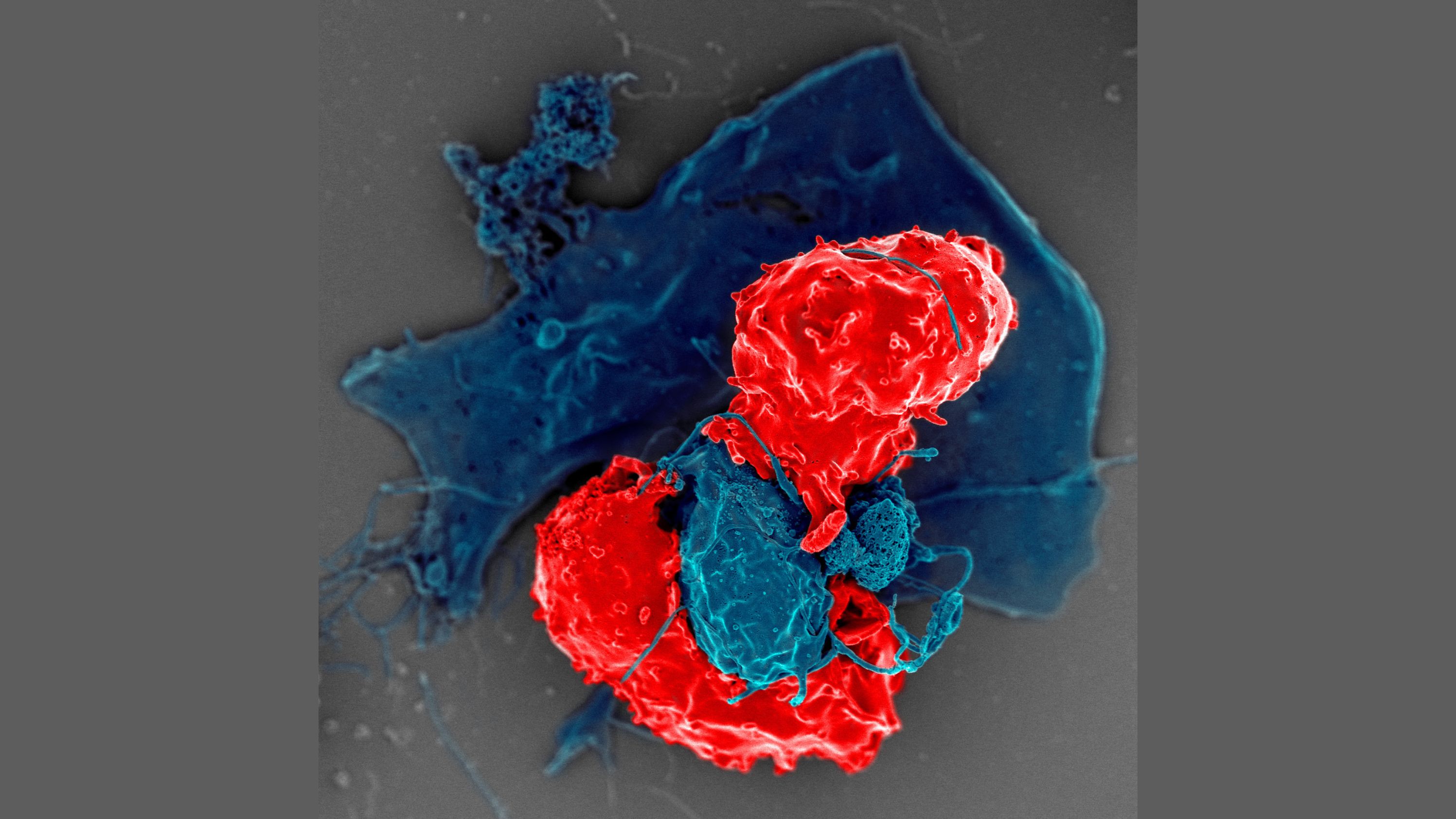 Protecting the body from itself