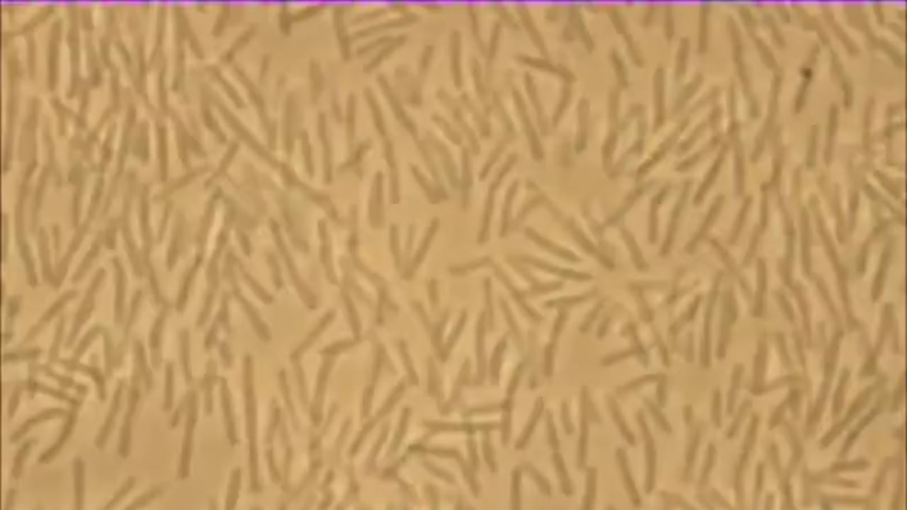 The yin and yang of bacterial turbulence